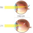 010안경 | [강남역, 서초동, 역삼동, 양재동]XSML ROUND 2018 XS 사이즈+ZEIZZ 클리어뷰 BG 후기