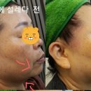 피부에설레다 이미지