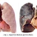 MTM전자담배 이미지