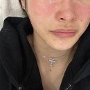 메이그루밍 | 도곡동 아나토미에스테틱 모공관리로 꿀피부만들기