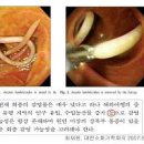 구충제 복용법 효과 부작용 종류 회충약 이미지