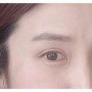 눈, 여기다 이미지