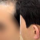 더예쁘게뷰티 네이버블로그