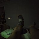 백제의료기기 | [골절일기2]사고 직후 +1Day(클라이밍 지구력 추락 사고 중족골 2,3,4번 골절)