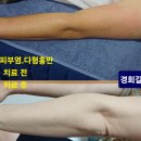 다형