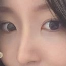 코명동지점 | 명동피부과 초음파 필러 녹이기 주사 히알라제 후기