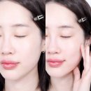 엑소프록실 시카 식물성 엑소좀 리얼 20 앰플 추천 후기 수분 광채 잡기