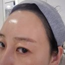 다산동 | 남양주 다산동피부과-이마거상실리프팅 후기