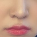 [창원] 댄의원 입술 필러 &amp; 입꼬리 보톡스 후기👄