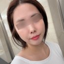 삼성바른피부과의원 | 삼성역 피부과 코엑스 ㅇㅇ의원 티타늄 리프팅 후기