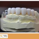 다이안치과기공소 이미지