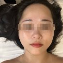 범계역 피부관리 맘스킨뷰티 | 물방울 ldm받고 속건조 잡은 후기
