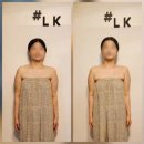 [LK테라피] 마포두골체형관리 소개로 유명한 아프지 않은 마포두골비체형CST 후기