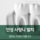 안성사랑니발치 잘하는 치과는 다릅니다