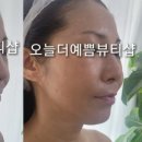 오늘 더예쁨뷰티샵