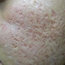 연세애드미피부과의원 이미지