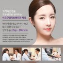 은이유