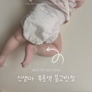 몽고반점 이미지