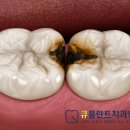 큐덴트 이미지