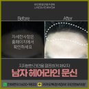 줌헤어라인
