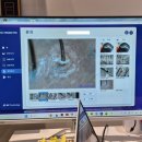 브래뉴헤어 제니스점 | 일산 탈모클리닉 브래뉴헤어 제니스점 두피클리닉, 헤드스파 후기