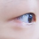 세란안과의원 이미지