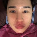 없는 저자극디바이스 <오큐라 티타늄셀 4.0> 물방울초음파 사용후기 쿼드쎄라티탄 펜타 톰더글로우...