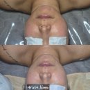 크라운에스테틱 | [군자윤곽관리/군자웨딩관리] 웨딩 크라운 윤곽관리 받고 온 후기! "에스테틱 오우시아"