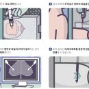 대원슈퍼마켓 | H대병원 유방미세석회 스테레오탁틱 조직생검술 검사후기