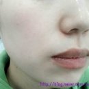 명품I당구장 - 6637 | 피부관리 받았어요~♡ /계양구 피부관리/비앤뷰 /달팡화장품