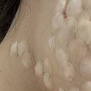 020.보산사거리_1 | 편평사마귀 세 번째 내돈내산 레이저 제거와 재생 관리 율무 화장품 구매 후기