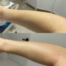 소온 | 대구왁싱 소온바디&amp;왁싱 재방문후기 손빠른 원장님 팔 다리 하프