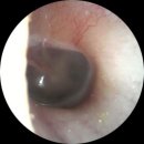 청담보청기 | [산곡동보청기] 서비스 까지 완벽한 청담보청기