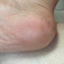 헬스힐 | 풋필터 수딩힐패드 후기, 뒤꿈치 각질 제거와 뒤꿈치 보습 한번에