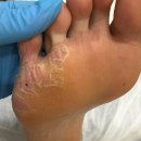 수연약품 | [시흥 뷰티수연 패디플래닝수강]은계 패디플래닝•은행동 패디플래닝 | 굳은살·발각질 제거로 맨발...