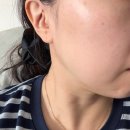 주관 | 메디율율무크림 피부오돌토돌 사용해보 주관후기