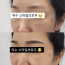 스마일브로우