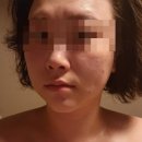 하우라 | 비대칭 고민 끝! 달서구 윤곽관리 '하우라' 첫 방문 리얼 후기