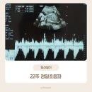 안중산부인과의원 | [임신일기]22주차 정밀초음파 검사 후기_안중산부인과(마미톡)
