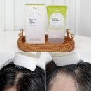엠스칼프헤어 | 헤어라인 관리 달리프 스칼프 앰플 후기