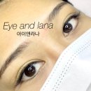 아이앤라나