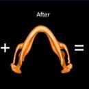 리온 메디 이미지