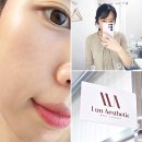 라인핏 | 옥정에스테틱 루아에스테틱 옥정점 라인핏 리프팅 만족후기