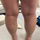 분당삼평-D-9 | 아기를 낳았다. (분당제일여성병원 출산 후기)