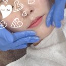 남포동피부관리 잘하는 뷰티홀릭에서 스킨플래닝