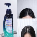 (주)피엔지 | 비듬샴푸 고민 지성 두피 냄새 각질 없애는 헤드앤숄더 프로페셔널 가려운 두피 케어 관리 샴푸 후기