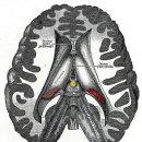 ﻿송과체 [松果體,pineal body] 이미지