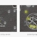 암환자에게 운동은 단순한 체력증진이 아니라 치료적 효과가 있다 이미지