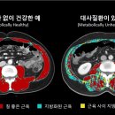 근육풀이 이미지