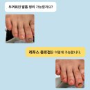 나도 손톱, 레푸스 개봉점 | [레푸스 종로점] 두꺼워진 발톱 스케일링 관리 후기 (정효경 푸스플레게)